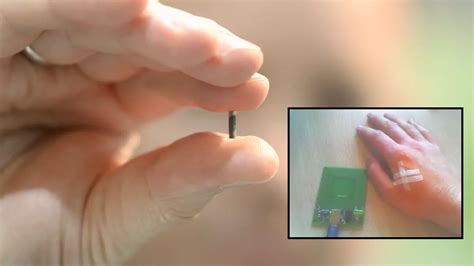 rfid implant under skin